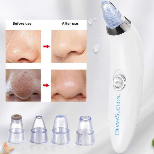 Derma suction- 4 in 1 Blackhead Remover